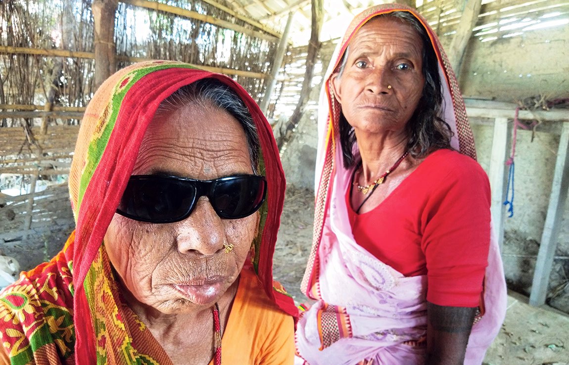 क्रिश्चियन संस्थाको शिविरमा शल्यक्रिया गर्नेहरुले गुमाए आँखाको ज्योती