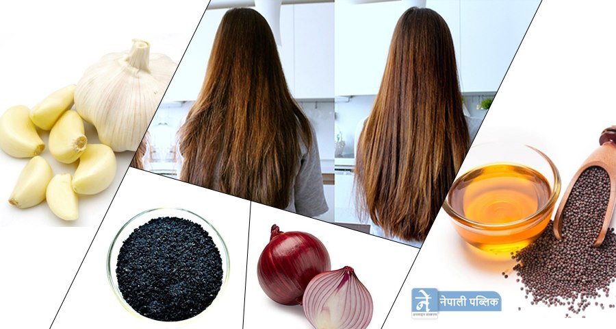 कपालकाे स्याहार गर्ने सजिलो घरेलु उपाय
